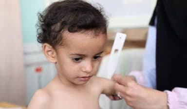 Những nguyên tắc vàng khi chăm sóc trẻ suy dinh dưỡng tại nhà