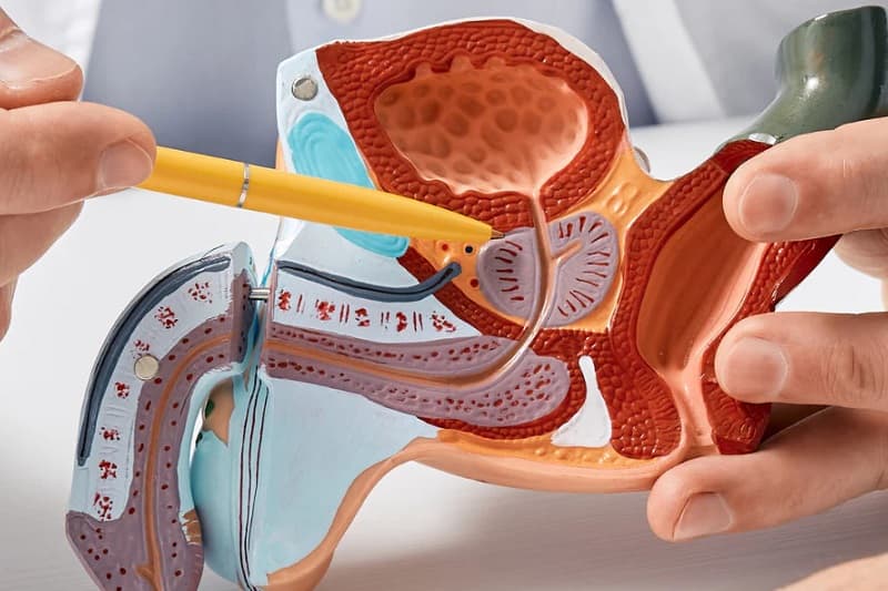 xét nghiệm ung thư tuyến tiền liệt