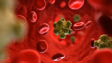 Nguyên nhân gây ung thư cổ tử cung phổ biến hiện nay