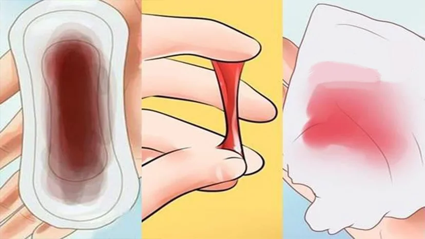 Nhận biết sớm các dấu hiệu ung thư cổ tử cung