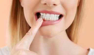 Nướu răng là gì? Cấu tạo, vai trò và những bệnh lý phổ biến