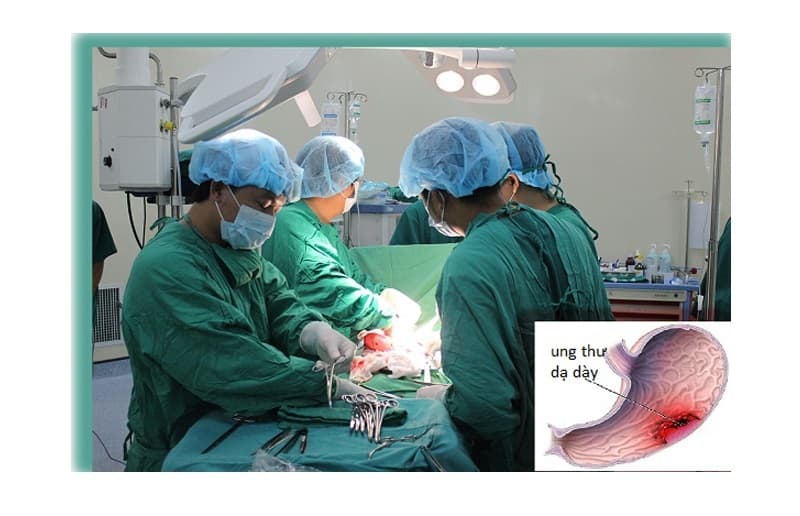 chữa ung thư dạ dày