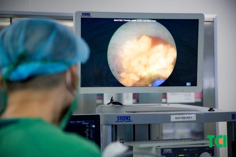 Cách chữa thận ứ nước độ 2 và 3