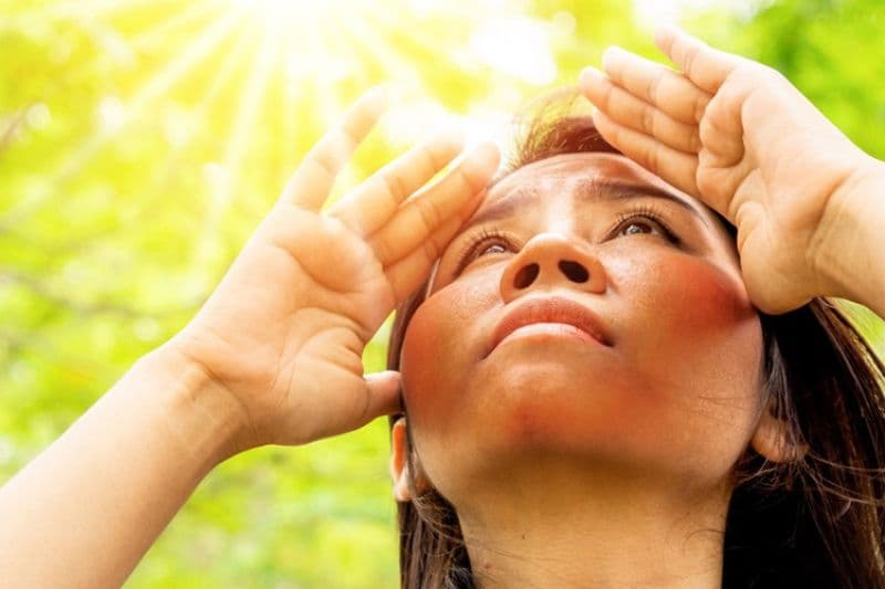 ánh nắng mặt trời dễ gây mắc ung thư da