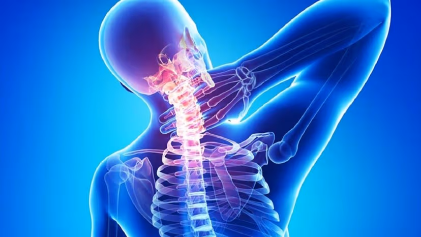 Thoái hoá cột sống cổ ở người trẻ: Dấu hiệu không nên bỏ qua