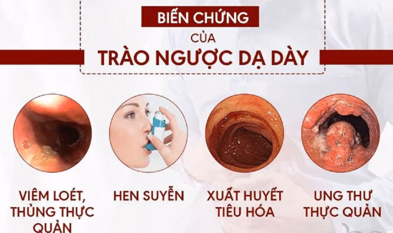 Bệnh trào ngược gây những tác hại rất lớn với sức khỏe người bệnh.