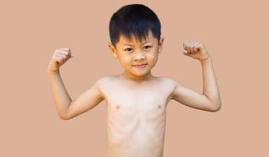 Nguyên nhân tiềm ẩn khiến trẻ bị suy dinh dưỡng kéo dài