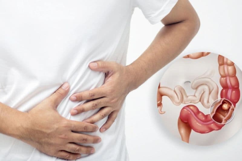 ung thư đại tràng di căn gan phổi và triệu chứng