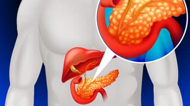 Triệu chứng viêm tụy cấp tính và mạn tính