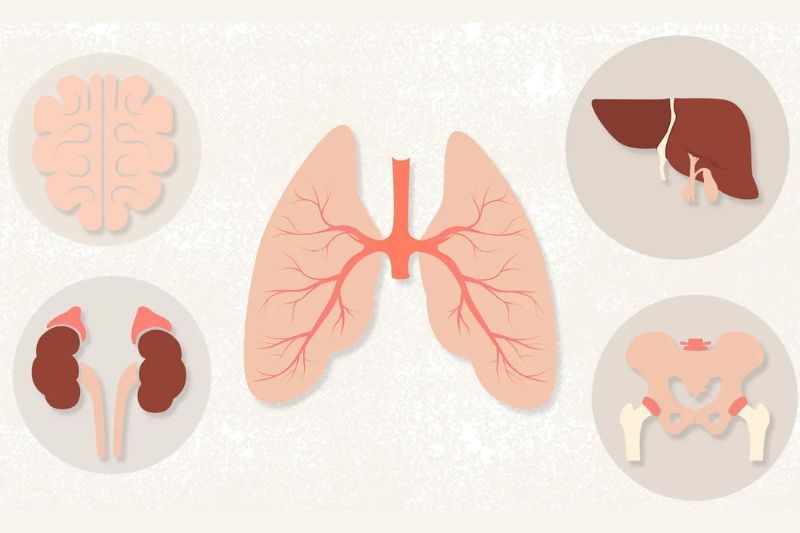 ung thư phổi có chữa được không khi có dấu hiện di căn