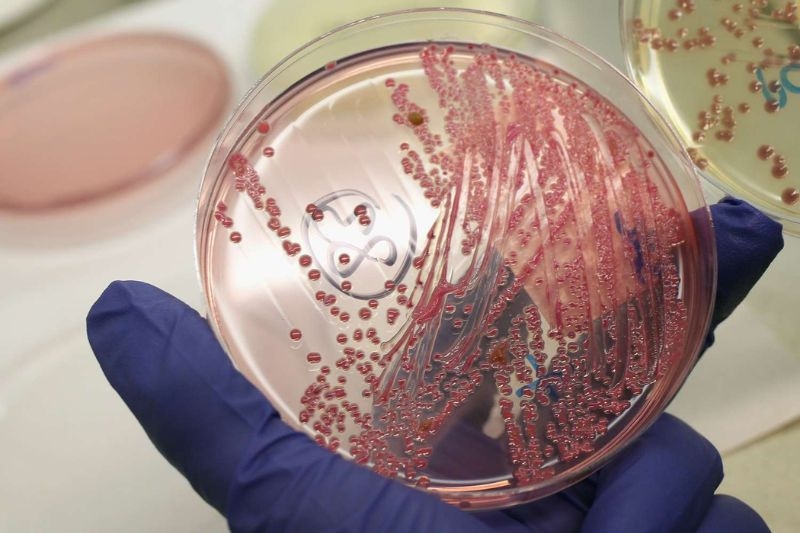 nuôi cấy vi khuẩn