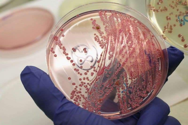 nuôi cấy vi khuẩn