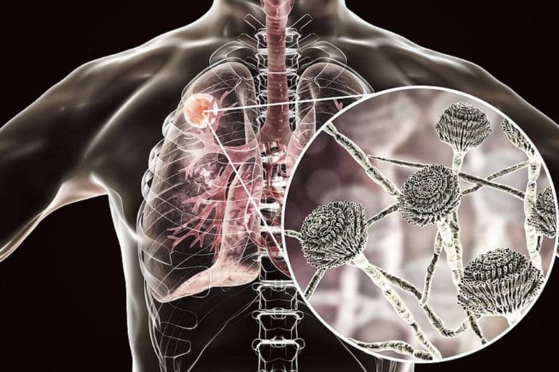 đi khám trước khi chuyển biến nặng