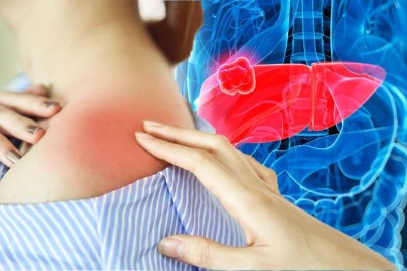 ung thư gan và triệu chứng