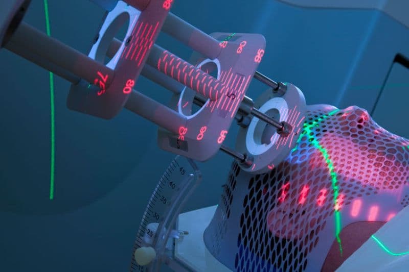 xạ trị ung thư vòm họng