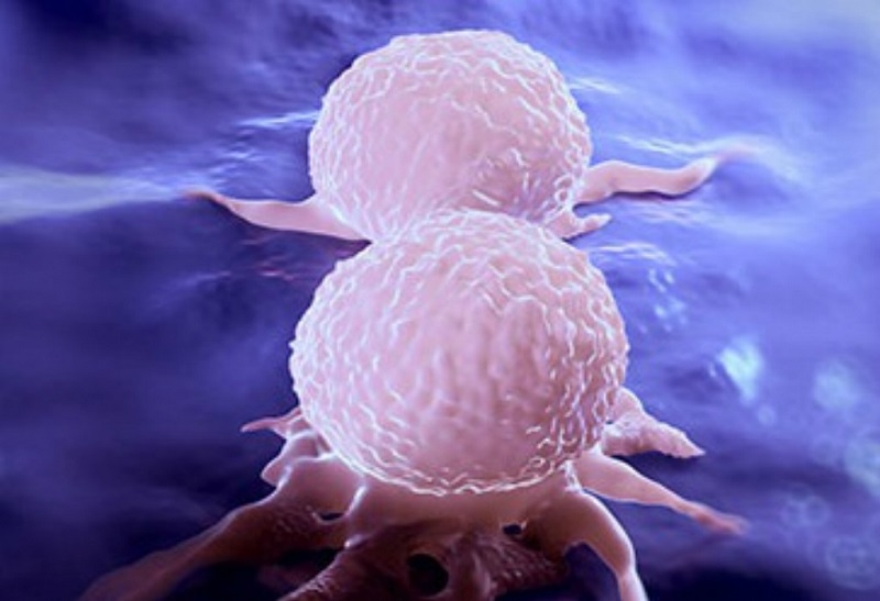 Cách chữa ung thư vú