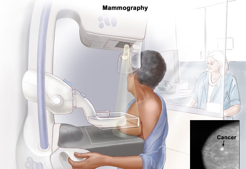 Tùy thuộc vào từng giai đoạn bệnh, đặc điểm sinh học của khối u và thể trạng tổng thể của người bệnh, bác sĩ sẽ xây dựng phác đồ điều trị phù hợp