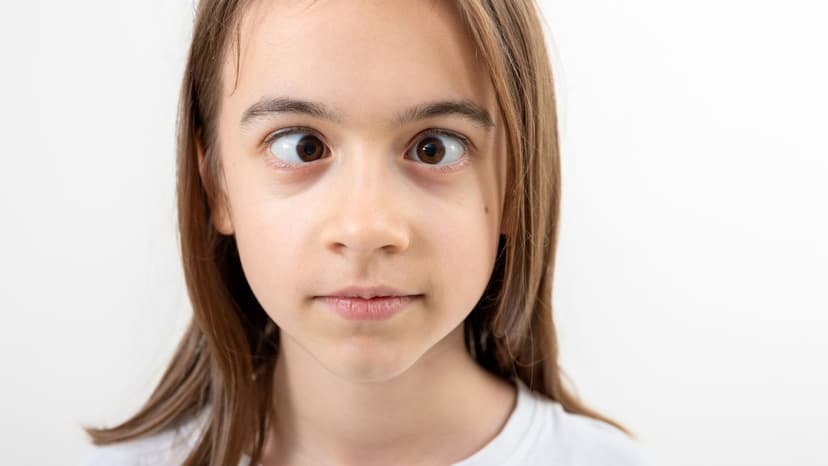 Những hiểu biết và cách trị mắt lác