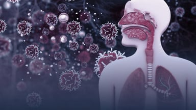 Cùng tìm hiểu yếu tố khởi phát hen phế quản là gì