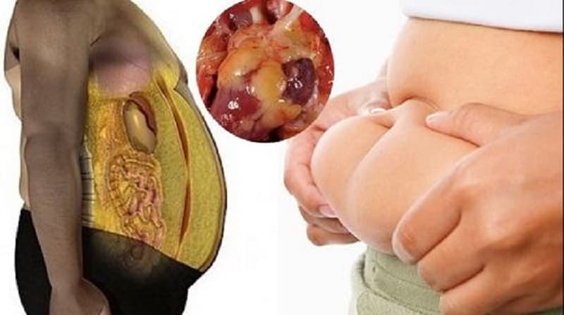 Tùy thuộc vào nguyên nhân gây bệnh, dấu hiệu của gan nhiễm mỡ có thể khác nhau