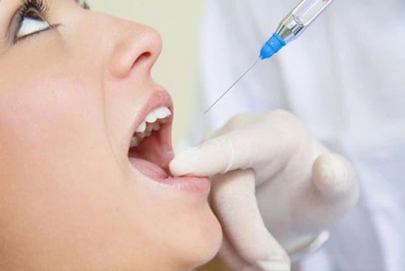 Bác sĩ tiến hành điều trị cười hở lợi bằng tiêm filler