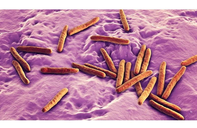 Nguyên nhân gây bệnh lao phổi hàng đầu là vi khuẩn Mycobacterium tuberculosis (vi khuẩn lao người)