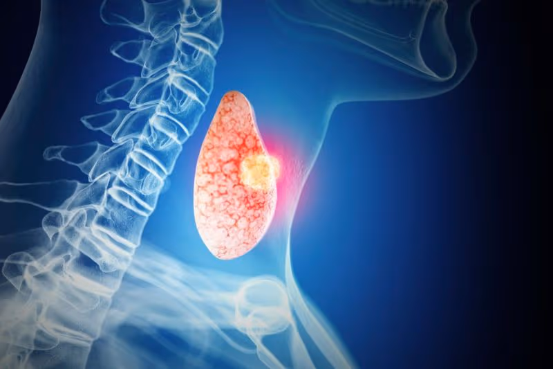 u giáp lành tính và nguyên nhân