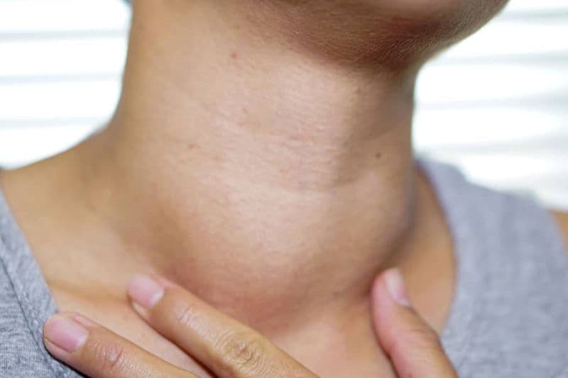 u nang tuyến giáp