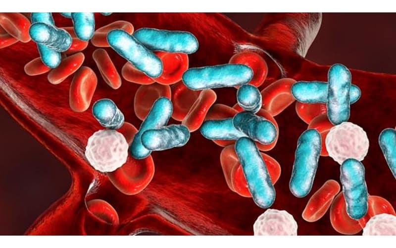 biểu hiện lâm sàng của áp xe phổi