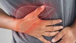 Những điều người mắc bệnh ung thư gan giai đoạn I cần chú ý