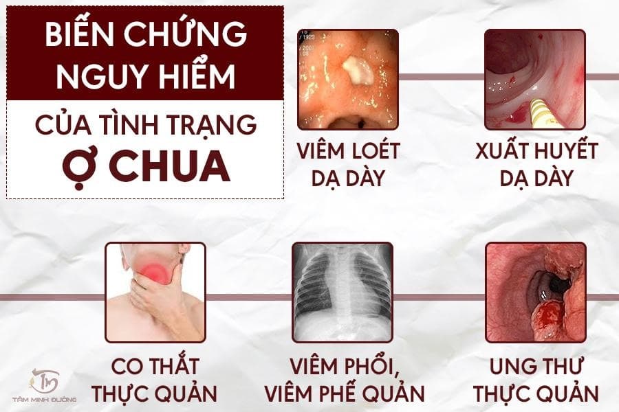 Tìm hiểu ợ chua là bệnh gì giúp mỗi người chủ động thăm khám và điều trị bệnh kịp thời.