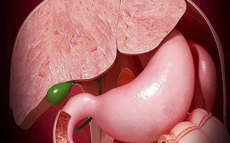 Hình ảnh túi mật - phẫu thuật túi mật