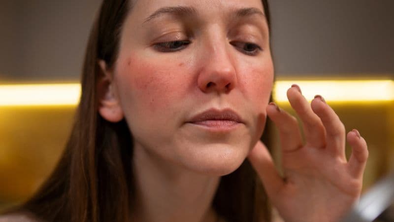 Triệu chứng cường giáp dễ nhận thấy