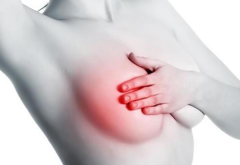 ung thư vú có chữa được không