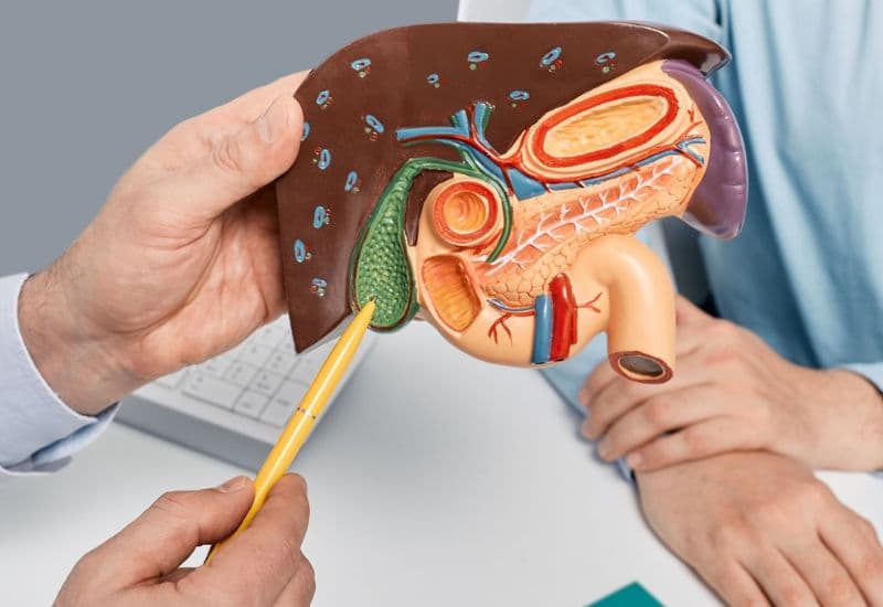 Các bệnh lý túi mật thường gặp