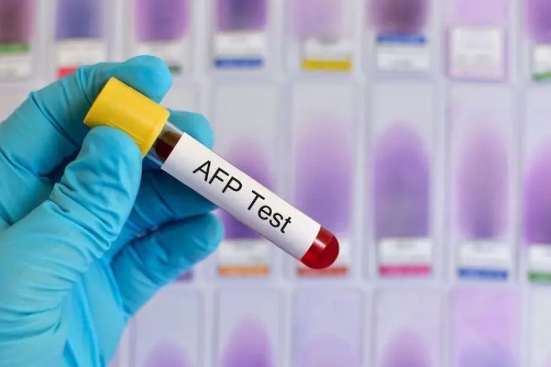 các loại xét nghiệm máu chẩn đoán ung thư gan