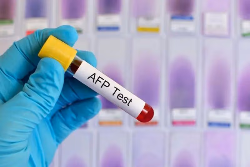 các loại xét nghiệm máu chẩn đoán ung thư gan