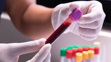 Xét nghiệm máu có biết ung thư gan không và lời khuyên