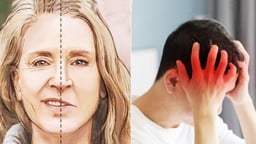 10 Nguyên nhân gây đột quỵ phổ biến nhất hiện nay