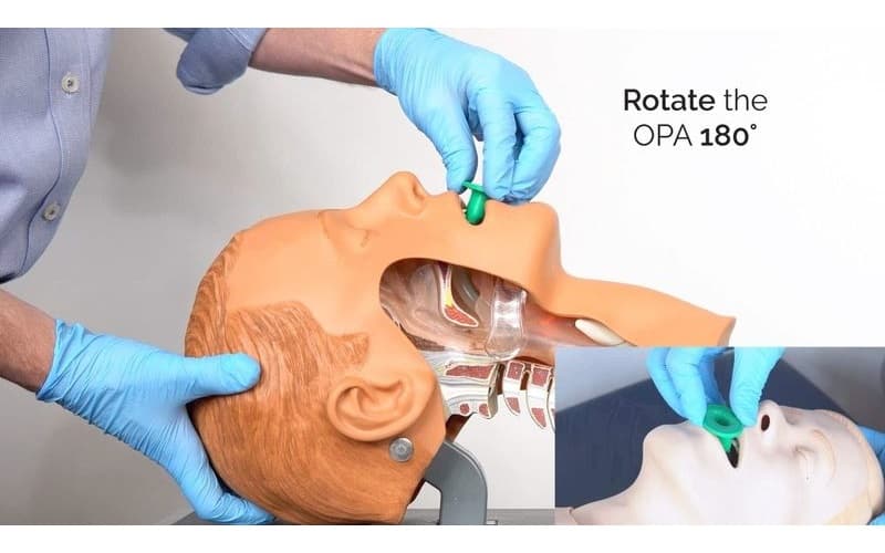 Phương pháp đặt nội khí quản