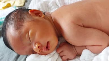 Con bị vàng da mẹ kiêng ăn gì và câu trả lời của bác sĩ