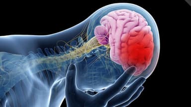 Các dạng đột quỵ não và cách nhận biết, điều trị