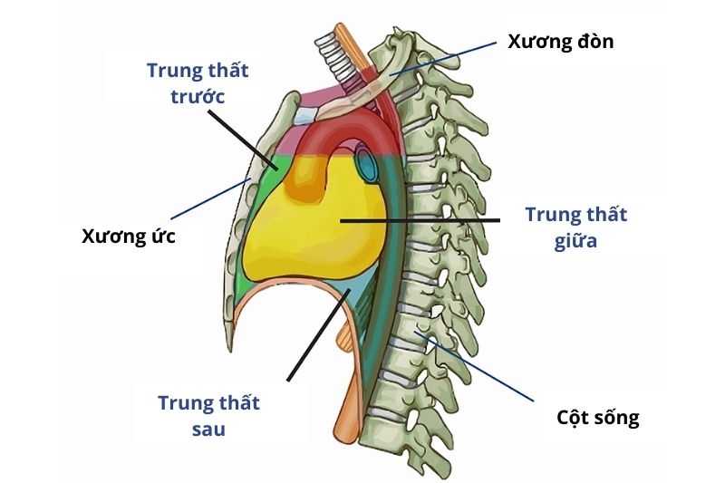 chẩn đoán x quang u trung thất