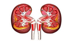 Làm sao để hết thận ứ nước: Cách điều trị và phòng ngừa hiệu quả