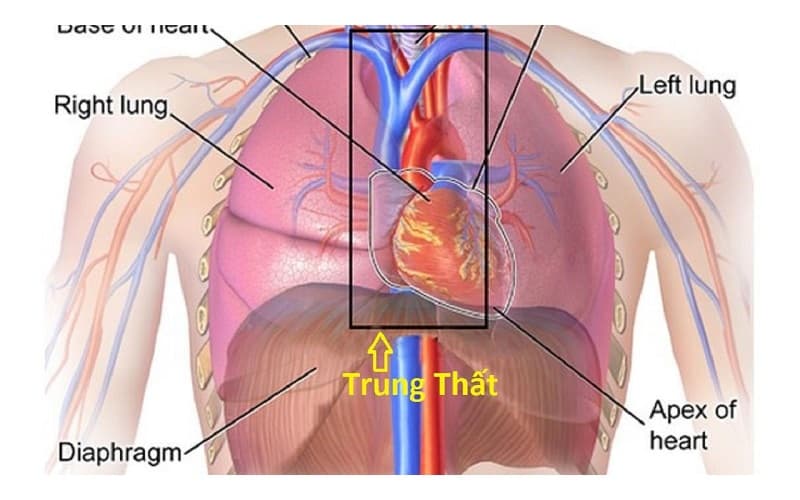 Khối u trung thất có thể xuất phát từ nhiều nguyên nhân khác nhau, tùy thuộc vào vị trí cụ thể của chúng trong lồng ngực