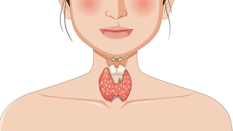 Basedow là bệnh gì và nguyên nhân gây bệnh