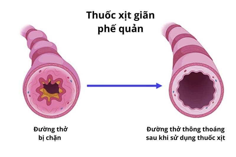 thuốc giãn phế quản tác dụng nhanh và chậm