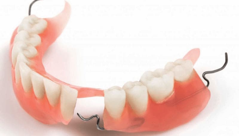 Phục hình răng giả tháo lắp: những điều cần biết