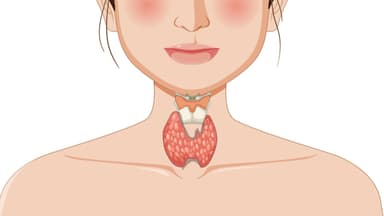 Nguyên nhân gây bệnh Basedow: Yếu tố khách quan và chủ quan