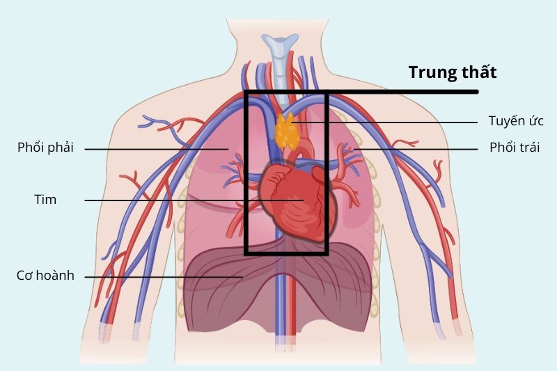 u lympho trung thất nguyên nhân